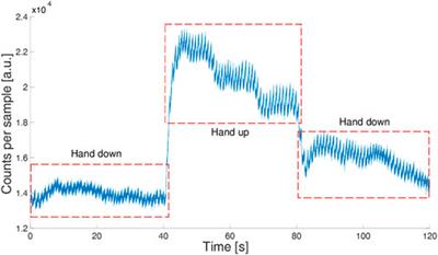 Multi-wavelength SPAD photoplethysmography for cardio-respiratory monitoring